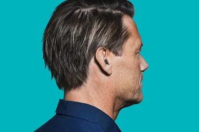 A man wearing an in-ear hearing aid.
